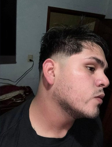 Resultado después de 4 semanas