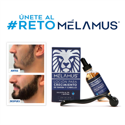 Mélamus Minoxidil